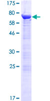 ab162674 on a 12.5% SDS-PAGE stained with Coomassie Blue.