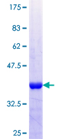 ab164561 on a 12.5% SDS-PAGE stained with Coomassie Blue.