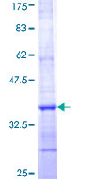 ab162793 on a 12.5% SDS-PAGE stained with Coomassie Blue.