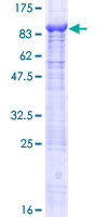 ab162816 on a 12.5% SDS-PAGE stained with Coomassie Blue.