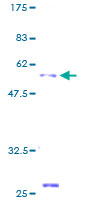 ab160800 on a 12.5% SDS-PAGE stained with Coomassie Blue.