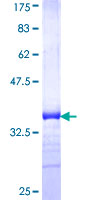 ab160801 on a 12.5% SDS-PAGE stained with Coomassie Blue.