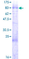 ab152606 on a 12.5% SDS-PAGE stained with Coomassie Blue.