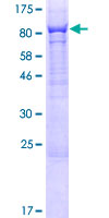 ab164987 on a 12.5% SDS-PAGE stained with Coomassie Blue.