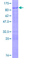 ab163987 on a 12.5% SDS-PAGE stained with Coomassie Blue.