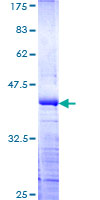 ab162933 on a 12.5% SDS-PAGE stained with Coomassie Blue.