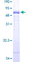 ab159111 on a 12.5% SDS-PAGE stained with Coomassie Blue.