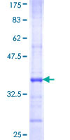 ab159112 on a 12.5% SDS-PAGE stained with Coomassie Blue.