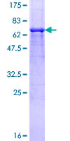 ab159113 on a 12.5% SDS-PAGE stained with Coomassie Blue.