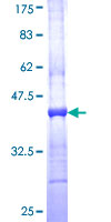 ab159114 on a 12.5% SDS-PAGE stained with Coomassie Blue.