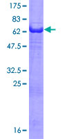 ab153187 on a 12.5% SDS-PAGE stained with Coomassie Blue.