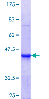 ab153188 on a 12.5% SDS-PAGE stained with Coomassie Blue.