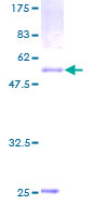 ab160113 on a 12.5% SDS-PAGE stained with Coomassie Blue.