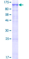 ab159132 on a 12.5% SDS-PAGE stained with Coomassie Blue.