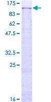 ab159137 on a 12.5% SDS-PAGE stained with Coomassie Blue.