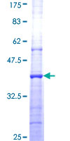 ab159138 on a 12.5% SDS-PAGE stained with Coomassie Blue.