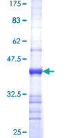 ab163671 on a 12.5% SDS-PAGE stained with Coomassie Blue.