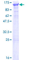 ab152608 on a 12.5% SDS-PAGE stained with Coomassie Blue.