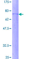 ab160059 on a 12.5% SDS-PAGE stained with Coomassie Blue.