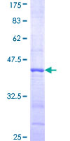 ab160060 on a 12.5% SDS-PAGE stained with Coomassie Blue.