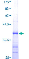 ab153319 on a 12.5% SDS-PAGE stained with Coomassie Blue.