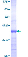 ab159128 on a 12.5% SDS-PAGE stained with Coomassie Blue.