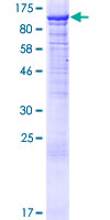 ab152609 on a 12.5% SDS-PAGE stained with Coomassie Blue.