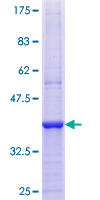 ab152610 on a 12.5% SDS-PAGE stained with Coomassie Blue.