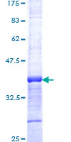 ab160322 on a 12.5% SDS-PAGE stained with Coomassie Blue.