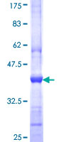 ab162085 on a 12.5% SDS-PAGE stained with Coomassie Blue.