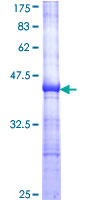 ab152990 on a 12.5% SDS-PAGE stained with Coomassie Blue.