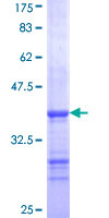 ab159119 on a 12.5% SDS-PAGE stained with Coomassie Blue.