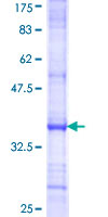 ab160510 on a 12.5% SDS-PAGE stained with Coomassie Blue.
