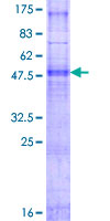 ab159120 on a 12.5% SDS-PAGE stained with Coomassie Blue.