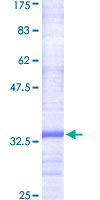 ab159121 on a 12.5% SDS-PAGE stained with Coomassie Blue.