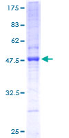 ab159122 on a 12.5% SDS-PAGE stained with Coomassie Blue.