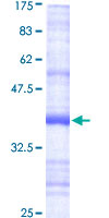 ab159123 on a 12.5% SDS-PAGE stained with Coomassie Blue.
