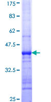 ab160770 on a 12.5% SDS-PAGE stained with Coomassie Blue.
