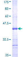 ab160509 on a 12.5% SDS-PAGE stained with Coomassie Blue.
