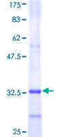 ab164934 on a 12.5% SDS-PAGE stained with Coomassie Blue.