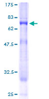 ab164649 on a 12.5% SDS-PAGE stained with Coomassie Blue.