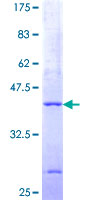 ab162464 on a 12.5% SDS-PAGE stained with Coomassie Blue.