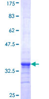 ab162465 on a 12.5% SDS-PAGE stained with Coomassie Blue.