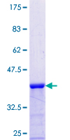 ab160333 on a 12.5% SDS-PAGE stained with Coomassie Blue.