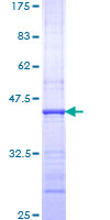 ab159124 on a 12.5% SDS-PAGE stained with Coomassie Blue.