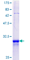 ab164955 on a 12.5% SDS-PAGE stained with Coomassie Blue.
