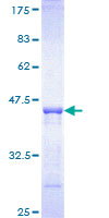 ab159125 on a 12.5% SDS-PAGE stained with Coomassie Blue.