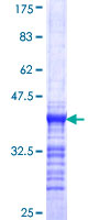 ab159126 on a 12.5% SDS-PAGE stained with Coomassie Blue.