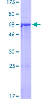 ab165010 on a 12.5% SDS-PAGE stained with Coomassie Blue.
