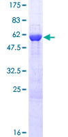 ab153154 on a 12.5% SDS-PAGE stained with Coomassie Blue.